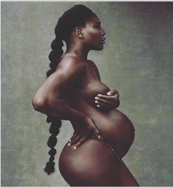 Pregnant Serena Williams Strips Down For Vanity Fair Magazine